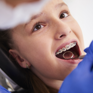 Brackets, ortodoncia