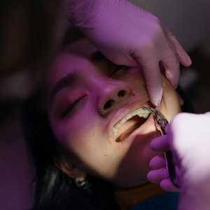Brackets, ortodoncia